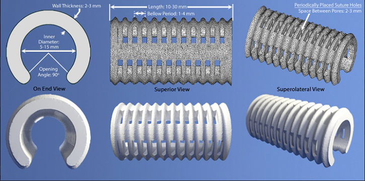 The 3D lung splint designed by Doctors Glenn Green and Scott Hollister. University of Michigan Medical Center. Image Courtesy: University of Michigan