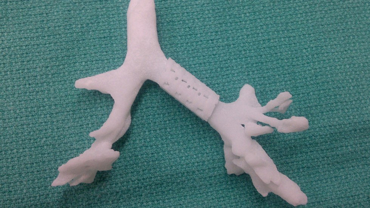 A close-up of the 3D-printed lung splint, fitted onto a model branch of lunch bronchi Image Courtesy: University of Michigan